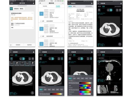 福建医疗影像下载