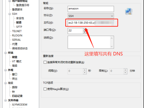 亚马逊连接教程