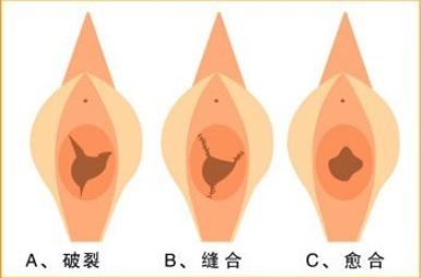 怎么看女生是不是处?